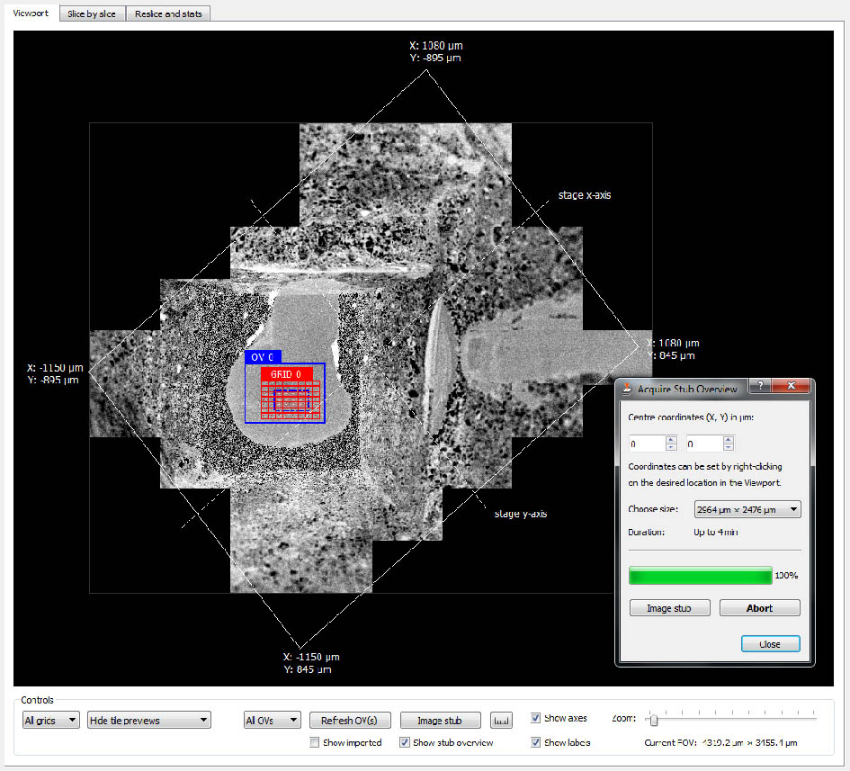 Stub Overview example